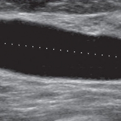 Echographie luxembourg