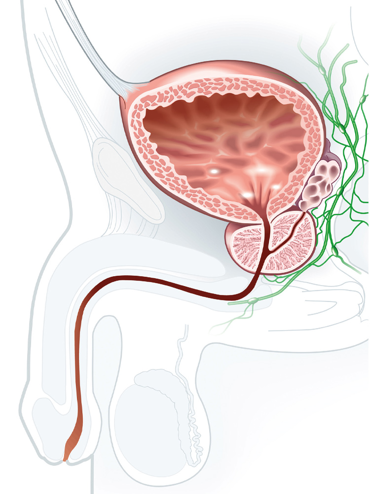 Schéma d'une prostate saine